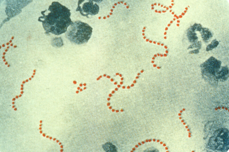 Image of UKHSA update on Scarlet Fever and Invasive Group Strep A